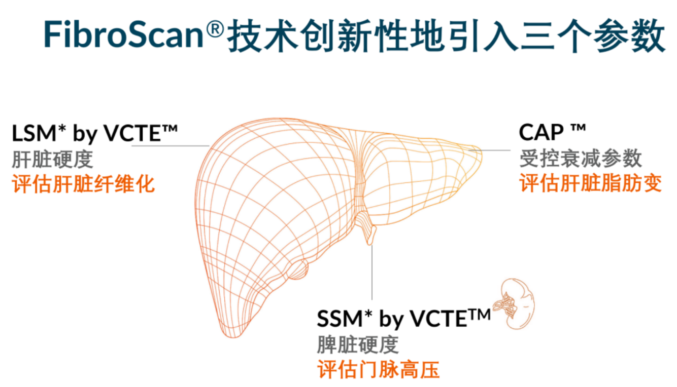 喜訊！FDA擴大了FibroScan?在肝臟綜合管理中的應(yīng)用范圍